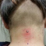 Neck piercing