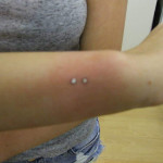 Arm piercing